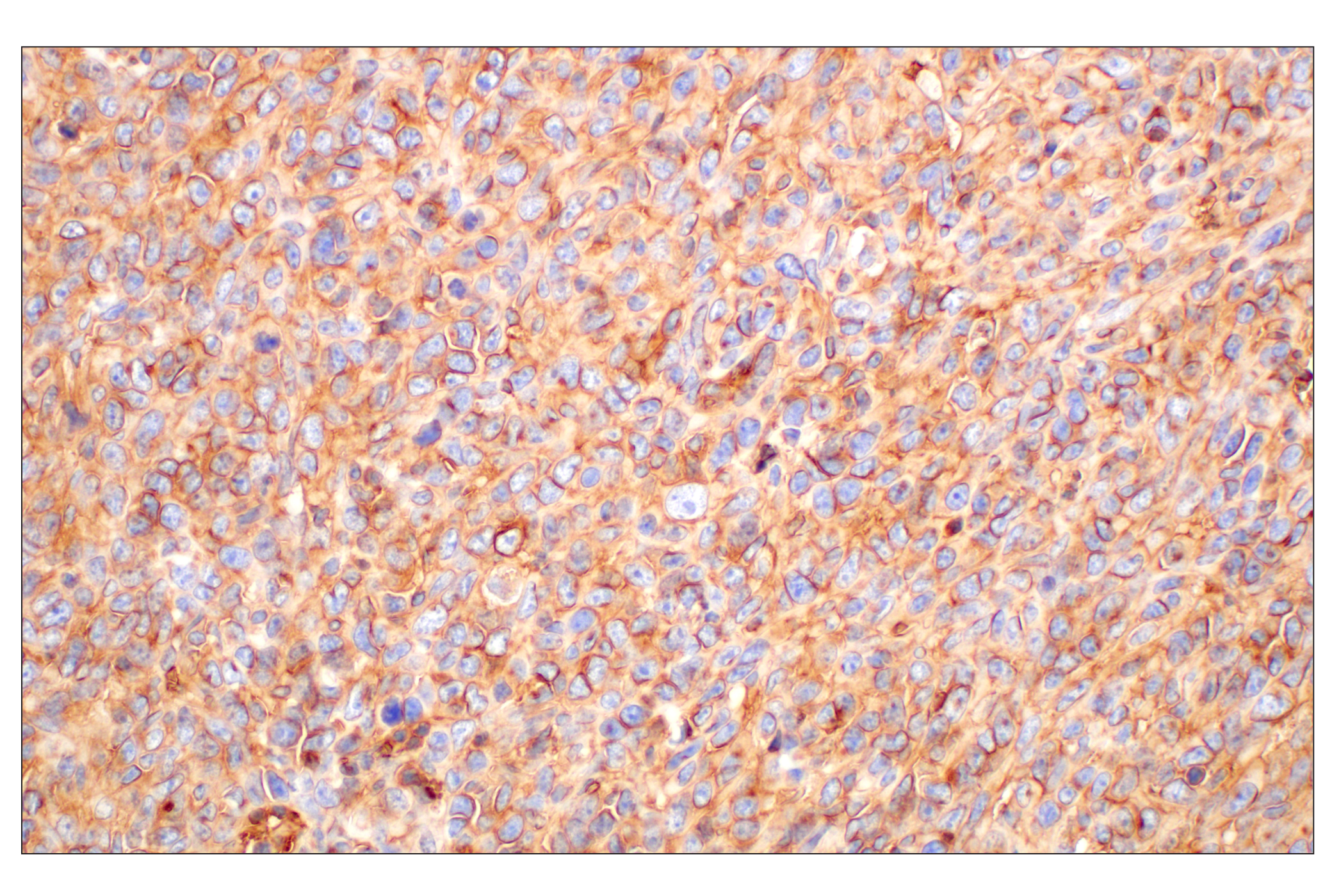 Immunohistochemistry Image 6: CD47 (E2V9V) Rabbit mAb (BSA and Azide Free)