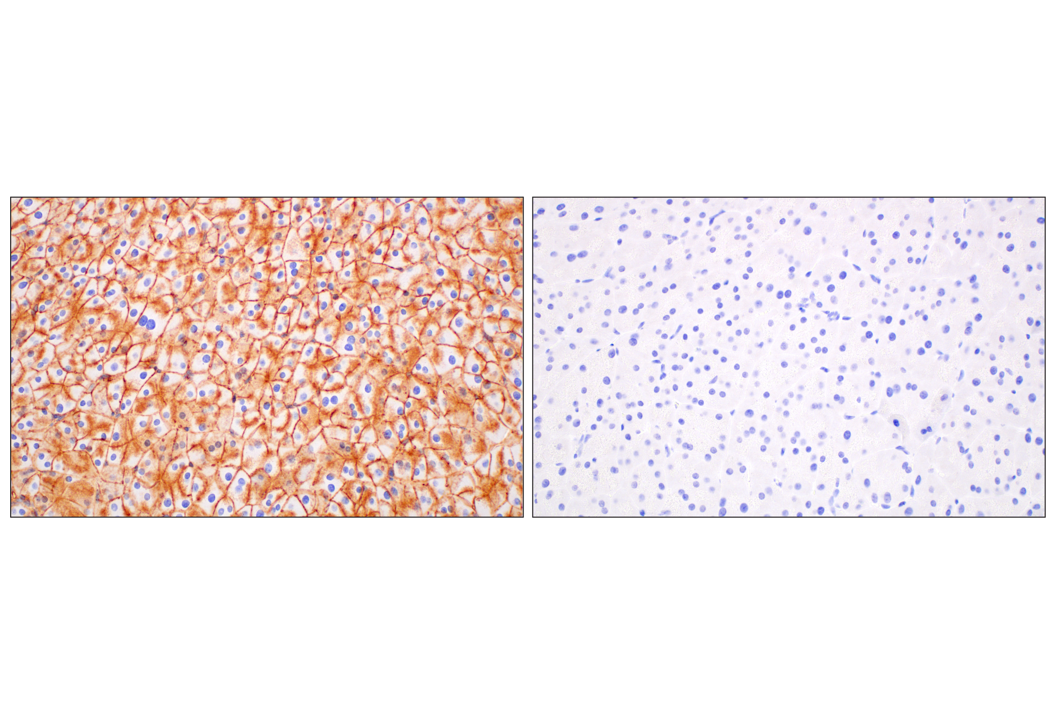 Immunohistochemistry Image 8: CD47 (E2V9V) Rabbit mAb (BSA and Azide Free)