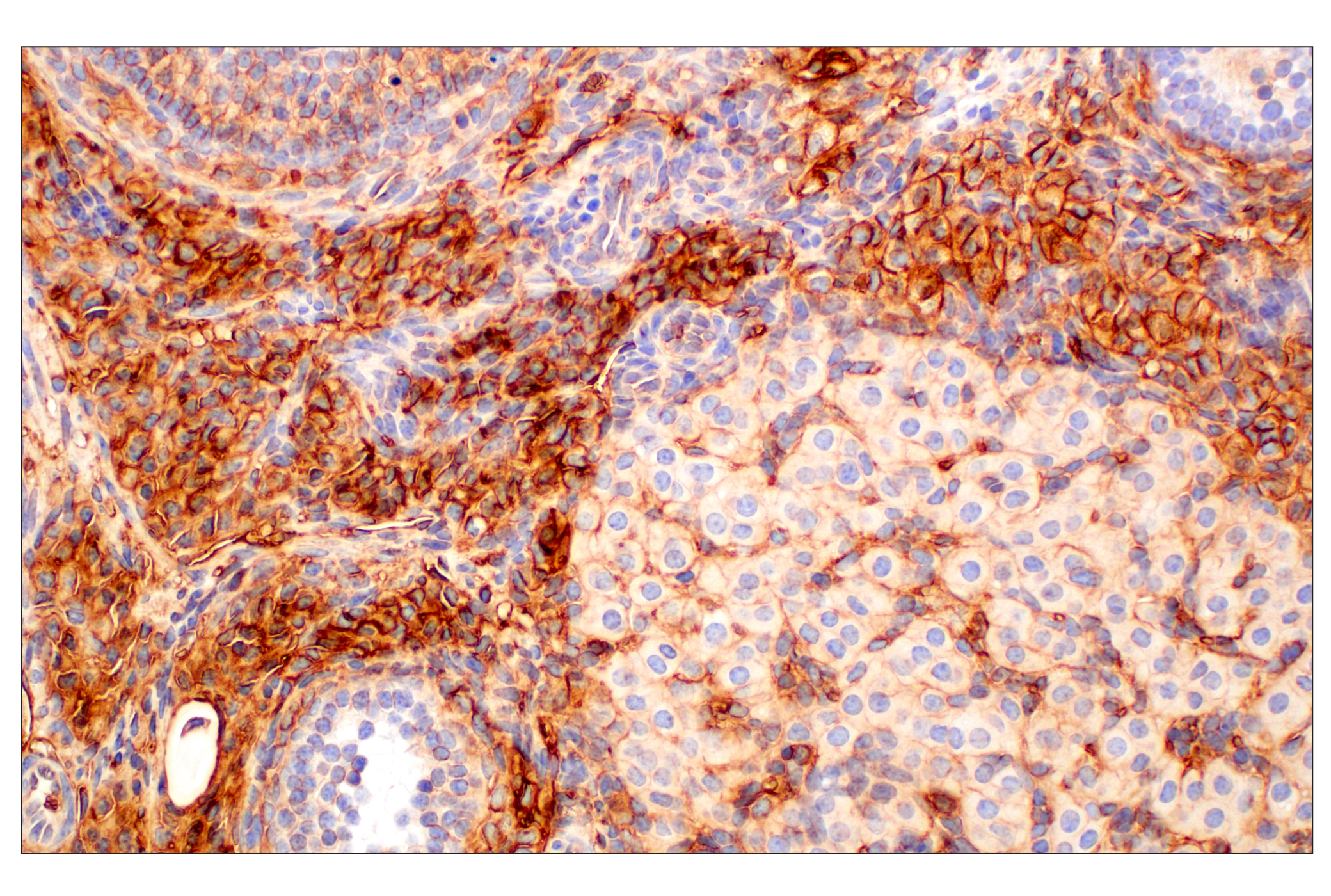 Immunohistochemistry Image 3: CD47 (E2V9V) Rabbit mAb (BSA and Azide Free)