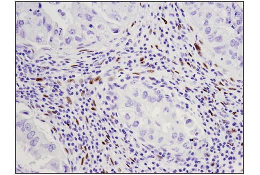 Immunohistochemistry Image 2: WT1 (D8I7F) XP® Rabbit mAb
