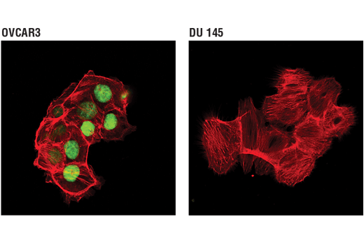 Immunofluorescence Image 1: WT1 (D8I7F) XP® Rabbit mAb