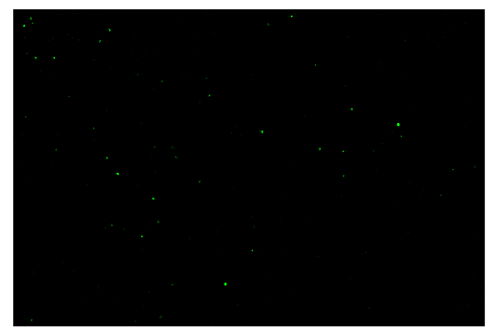 Immunohistochemistry Image 2: Granzyme B (E5V2L) & CO-0049-594 SignalStar™ Oligo-Antibody Pair