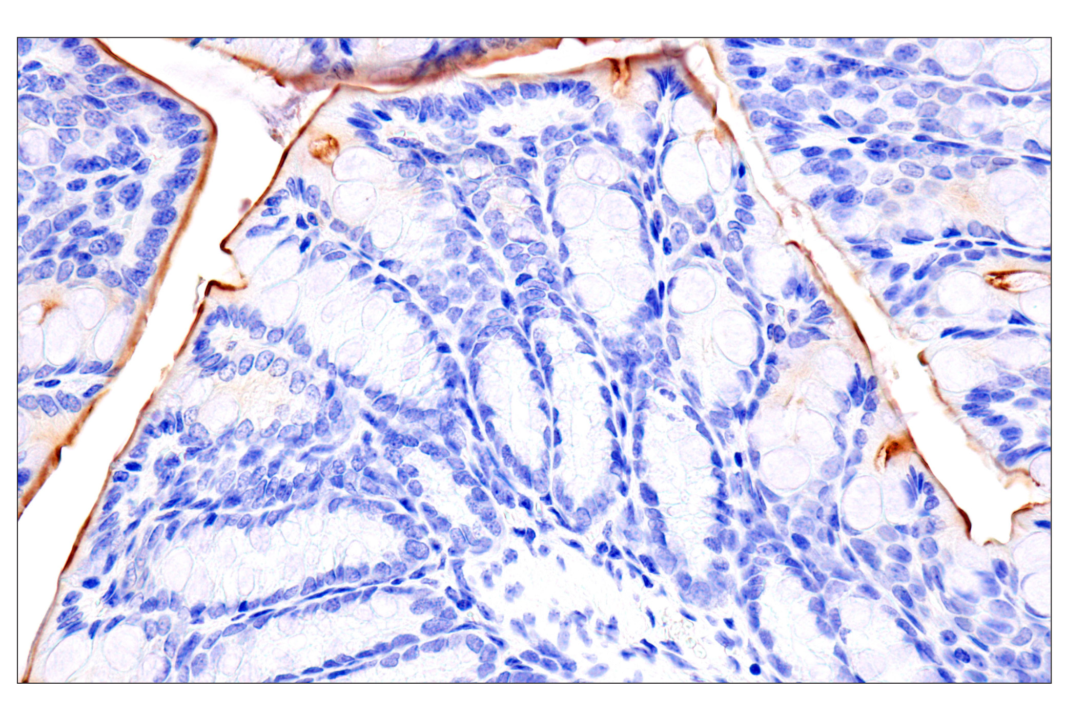 Immunohistochemistry Image 7: DPEP-1/MDP (E5H7T) Rabbit mAb