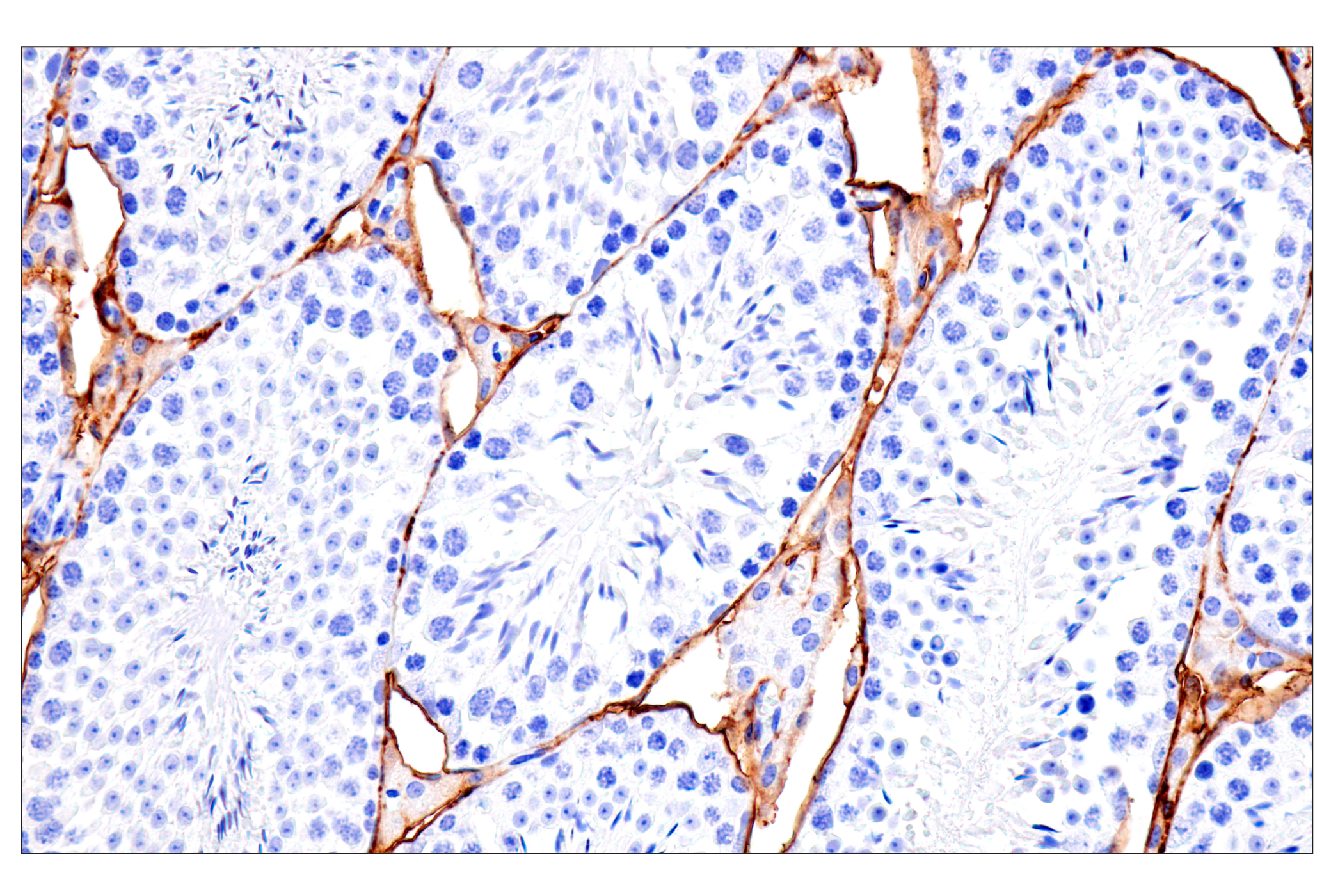 Immunohistochemistry Image 1: DPEP-1/MDP (E5H7T) Rabbit mAb
