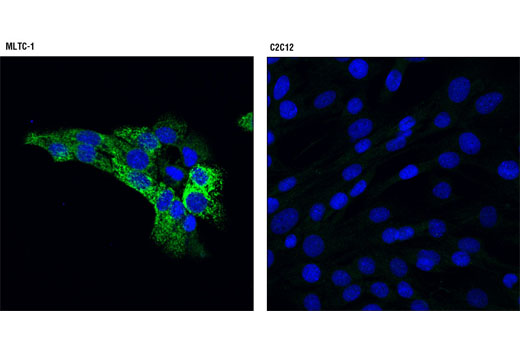 Immunofluorescence Image 1: StAR (D10H12) XP® Rabbit mAb