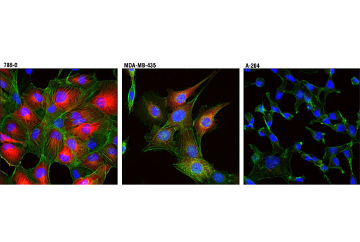 Immunofluorescence Image 2: Phospho-NDRG1 (Thr346) (D98G11) XP® Rabbit mAb (Alexa Fluor® 594 Conjugate)