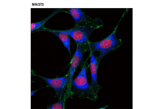 Immunofluorescence Image 1: PDI (C81H6) Rabbit mAb (Alexa Fluor® 647 Conjugate)