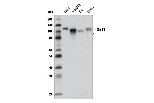  Image 31: Hypoxia Activation IHC Antibody Sampler Kit