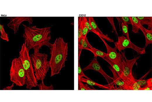 Immunofluorescence Image 2: SirT1 (1F3) Mouse mAb