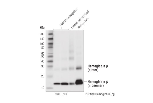 Western Blotting Image 1: Hemoglobin β (D4W4I) Rabbit mAb