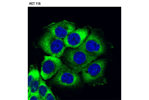 Immunofluorescence Image 1: USP10 (D7A5) Rabbit mAb