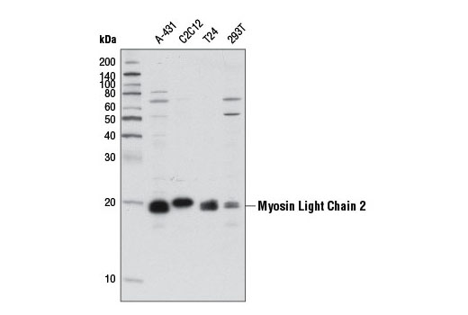 Western Blotting Image 1: Myosin Light Chain 2 (D18E2) Rabbit mAb