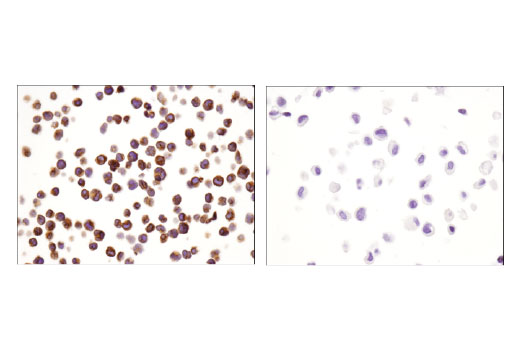  Image 70: Human Exhausted CD8+ T Cell IHC Antibody Sampler Kit