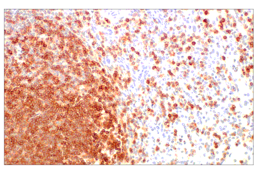  Image 57: Human Immune Cell Phenotyping IHC Antibody Sampler Kit