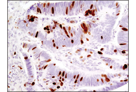  Image 19: PhosphoPlus® Rb (Ser780, Ser807/811) Antibody Kit