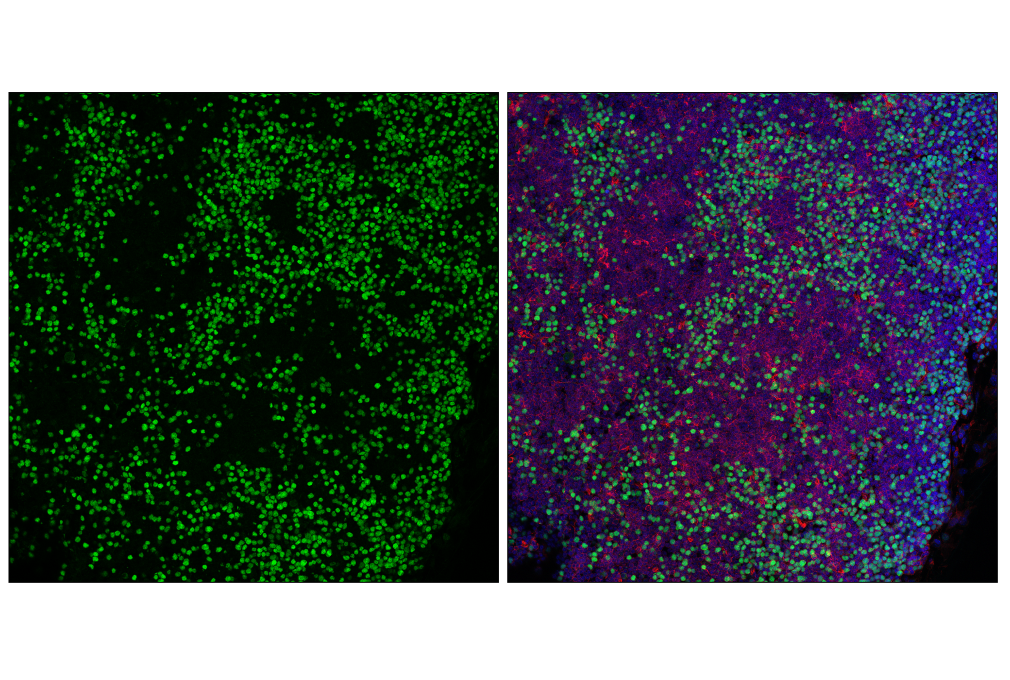 Immunofluorescence Image 3: Phospho-Rb (Ser807/811) (D20B12) XP® Rabbit mAb