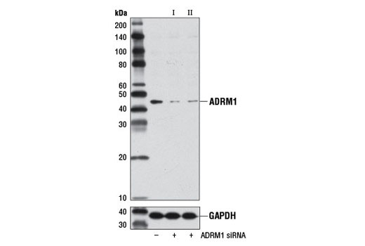  Image 1: SignalSilence® ADRM1 siRNA II