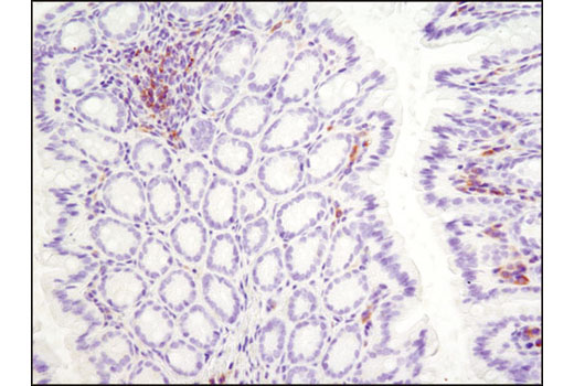  Image 35: B Cell Signaling Antibody Sampler Kit II