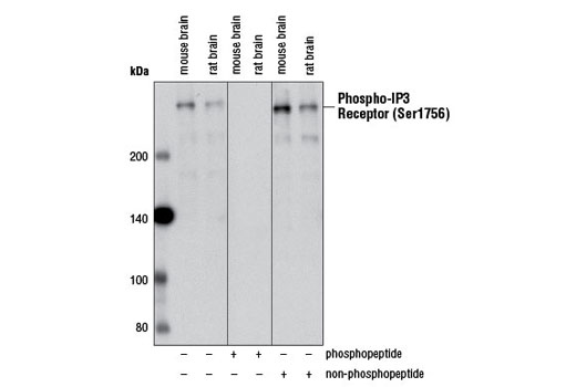 Western Blotting Image 1: Phospho-IP3 Receptor (Ser1756) (D10E3) Rabbit mAb