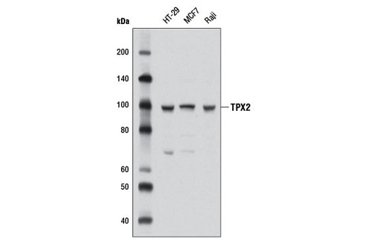 Western Blotting Image 1: TPX2 Antibody