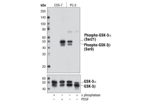  Image 6: GSK-3 Antibody Sampler Kit