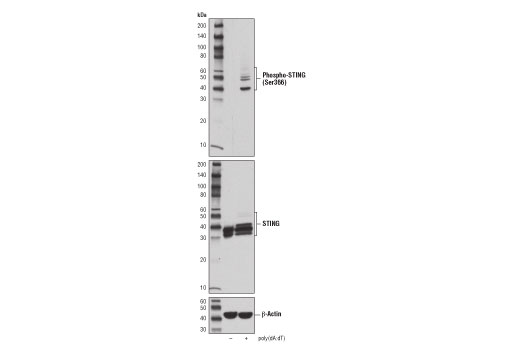 Western Blotting Image 1: Phospho-STING (Ser366) Antibody