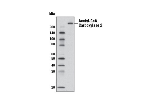  Image 6: Acetyl-CoA Carboxylase 1 and 2 Antibody Sampler Kit