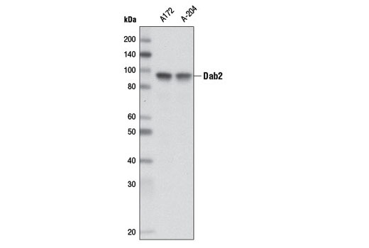 Western Blotting Image 1: Dab2 Antibody