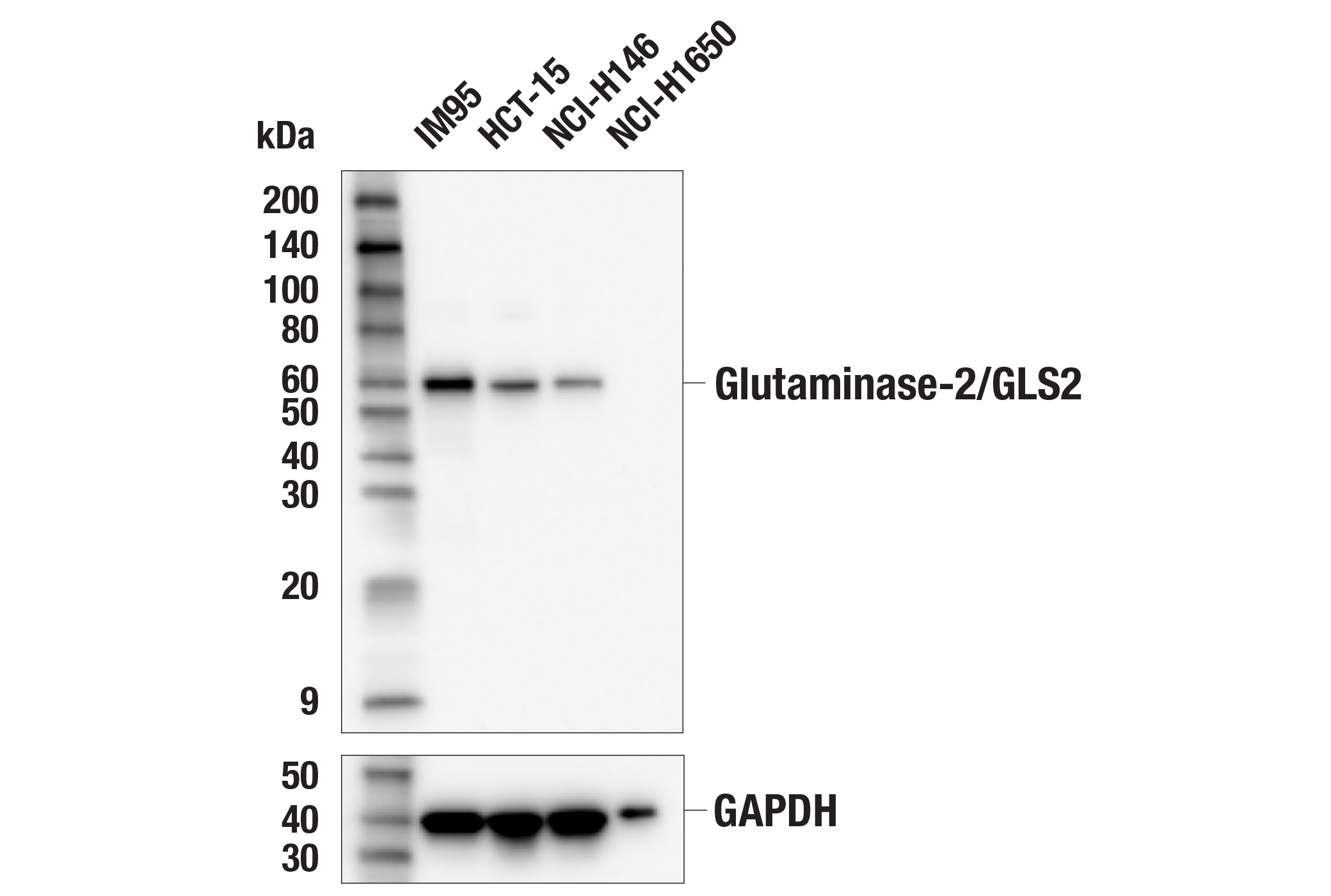 Western Blotting Image 1: Glutaminase-2/GLS2 (E9C7V) Rabbit mAb
