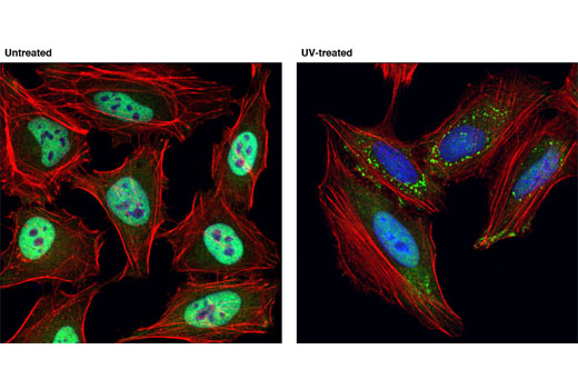 Immunofluorescence Image 1: TIAR (D26E4) Rabbit mAb