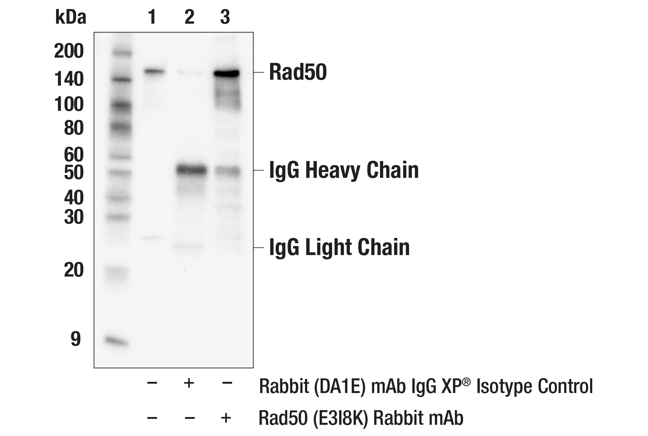 Immunoprecipitation Image 1: Rad50 (E3I8K) Rabbit mAb