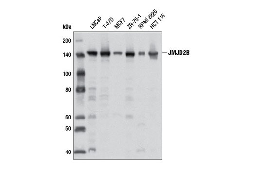  Image 10: Jumonji Family Antibody Sampler Kit