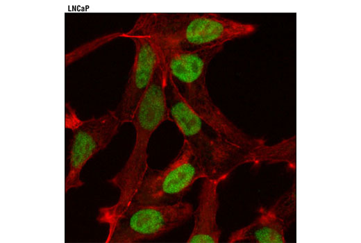Immunofluorescence Image 1: JMJD2B (D7E6) Rabbit mAb