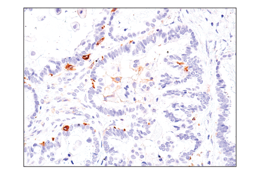 Immunohistochemistry Image 4: Axl (C89E7) Rabbit mAb