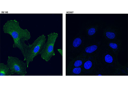 Immunofluorescence Image 1: Axl (C89E7) Rabbit mAb