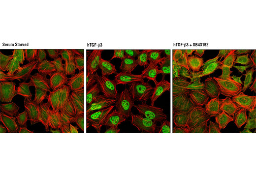 Immunofluorescence Image 1: SMAD2/3 (D7G7) XP® Rabbit mAb
