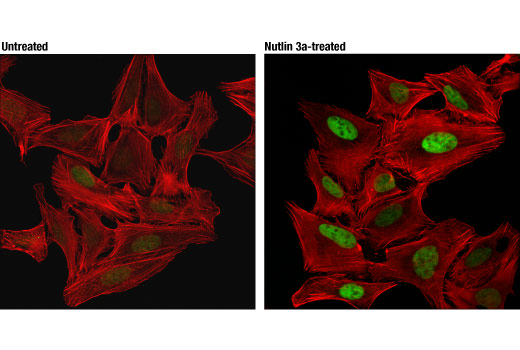 Immunofluorescence Image 1: MDM2 (D1V2Z) Rabbit mAb