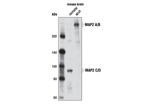  Image 11: Mature Neuron Marker Antibody Sampler Kit