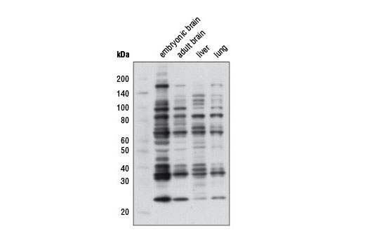 Western Blotting Image 1: Mono-Methyl Arginine (R*GG) (D5A12) Rabbit mAb