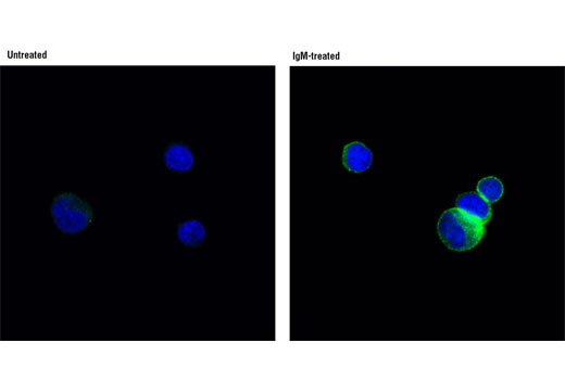 Immunofluorescence Image 1: Phospho-HS1 (Tyr378/397) (D12C1) XP® Rabbit mAb