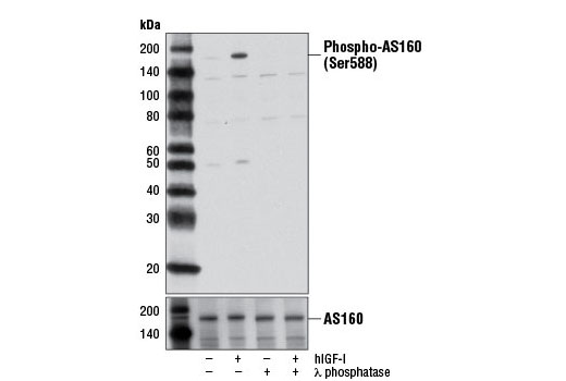  Image 10: AS160 Signaling Antibody Sampler Kit