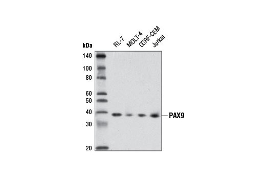 Western Blotting Image 1: PAX9 Antibody