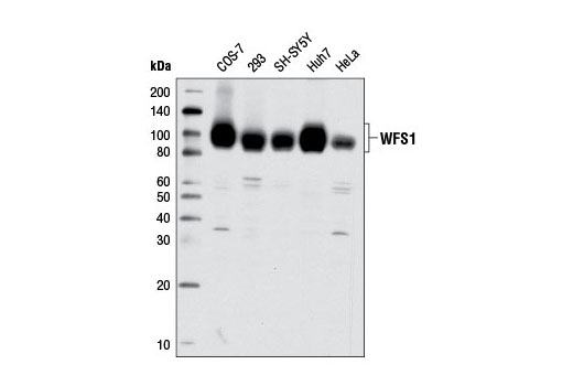 Western Blotting Image 1: WFS1 Antibody
