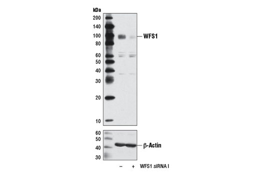 Western Blotting Image 2: WFS1 Antibody