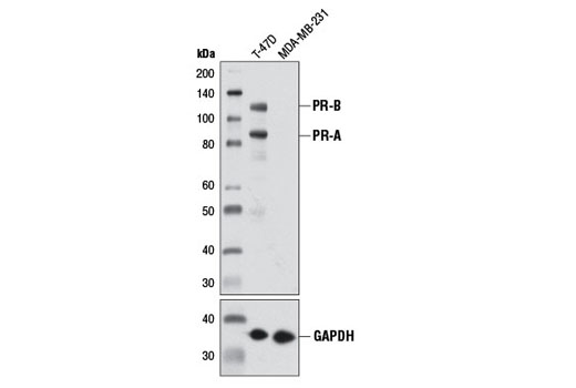 Western Blotting Image 1: Progesterone Receptor A/B (D8Q2J) XP® Rabbit mAb