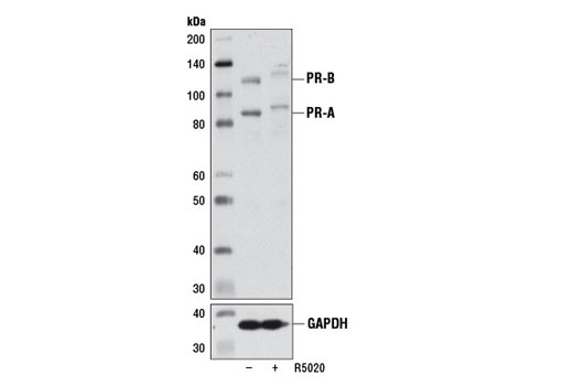 Western Blotting Image 2: Progesterone Receptor A/B (D8Q2J) XP® Rabbit mAb