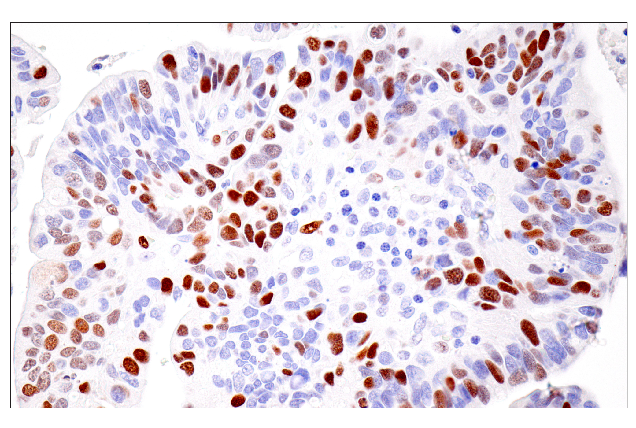 Immunohistochemistry Image 7: UHRF1 (E5W8W) Rabbit mAb