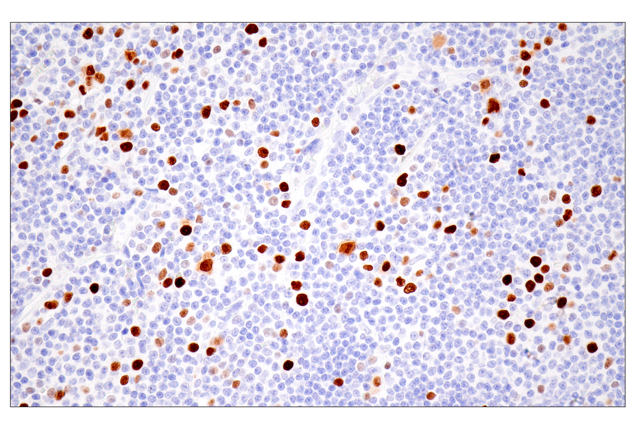 Immunohistochemistry Image 4: UHRF1 (E5W8W) Rabbit mAb