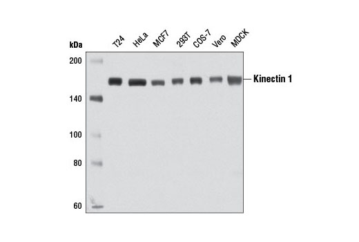 Western Blotting Image 1: Kinectin 1 Antibody