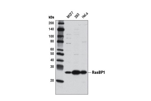 Western Blotting Image 1: RanBP1 Antibody